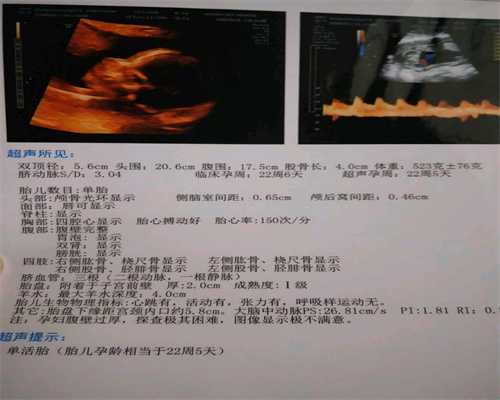 武汉有要代孕的吗_武汉找代孕 有私聊吗_深圳孕宝国际可靠吗：代孕生子公司