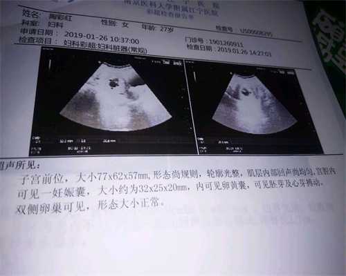 武汉代孕一年多少钱_武汉是否有代孕成功的人_贵医做试管婴儿如何：宫腔内人